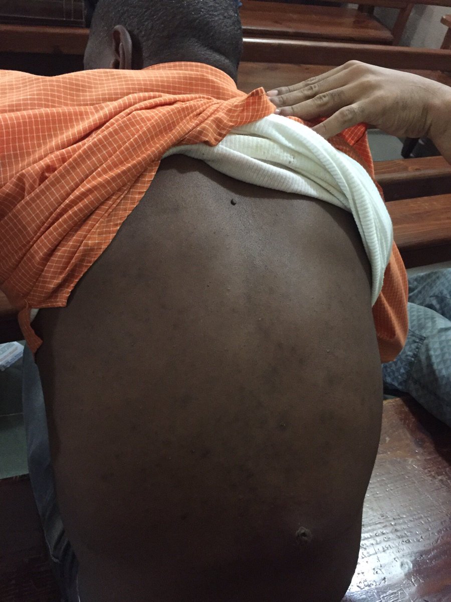 SalvadorReports's tweet photo. Grave!! preso narra ante juez fue torturado para que testificara... miren el video. Dios mio!, pobre justicia https://t.co/j9MmOoSDbj