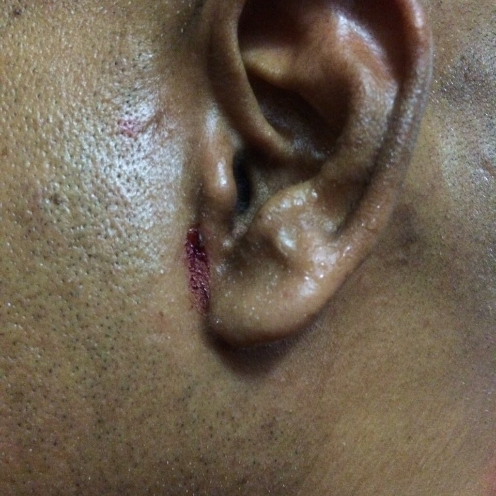 anuahsa's tweet photo. Now what do you say to the officers of @PoliceMv who did this? @UmarNaseerPPM. https://t.co/2qNbJj3wEv