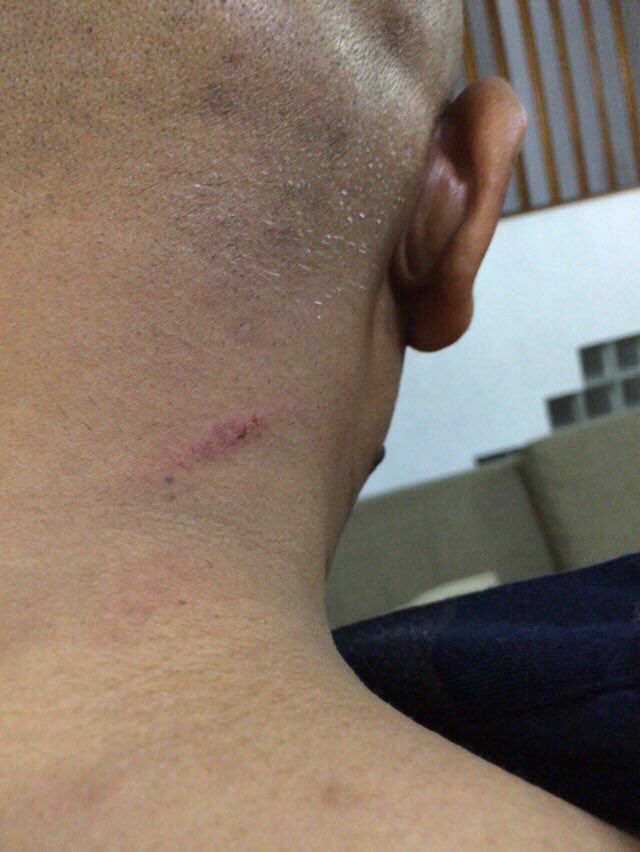anuahsa's tweet photo. Now what do you say to the officers of @PoliceMv who did this? @UmarNaseerPPM. https://t.co/2qNbJj3wEv