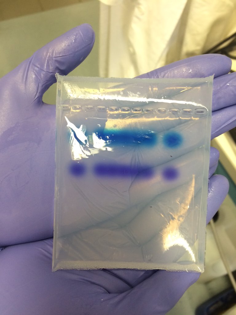 KdElena's tweet photo. Le piccole soddisfazioni quotidiane del laboratorio 😍 #thecoloursofscience #electrophoresis https://t.co/9MJmUKoweW