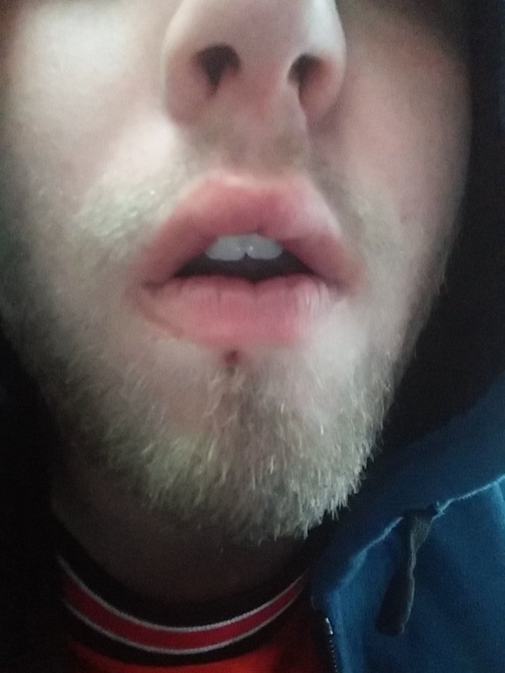 Construct_Kevin's tweet photo. Put my tooth through my lip during the pit https://t.co/3qxtuPPirn