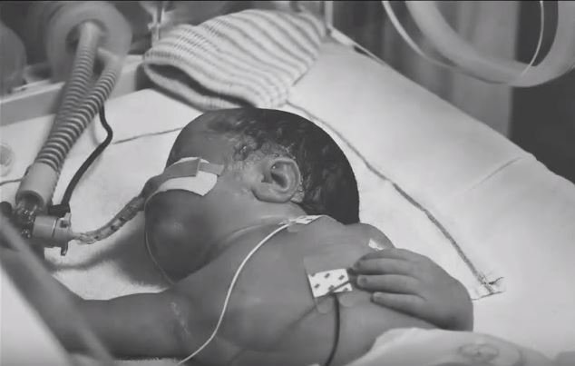 BiomedicNL's tweet image. Voor alle vroeggeborenen en hun papa's &amp;amp; mama's  #wpd15
Lullaby @exit31music Prachtig! ow.ly/UKM1g