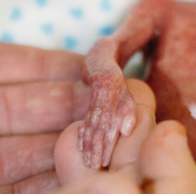LilaGraceRose's tweet photo. The humanity of these babies, born premature, shows us why we must protect the preborn. #worldprematurityday https://t.co/clx86E1Ks0