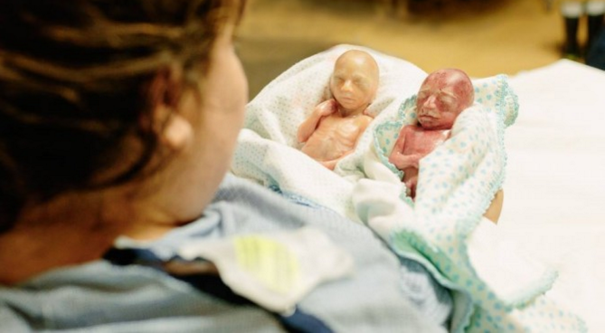 LilaGraceRose's tweet photo. The humanity of these babies, born premature, shows us why we must protect the preborn. #worldprematurityday https://t.co/clx86E1Ks0