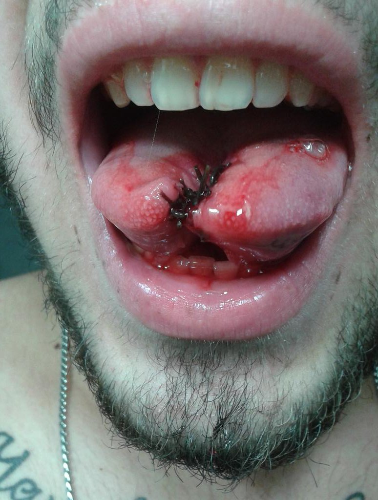 GonzaSilva5's tweet image. Mi lengua en este momento #LenguaBífida 👅🔪