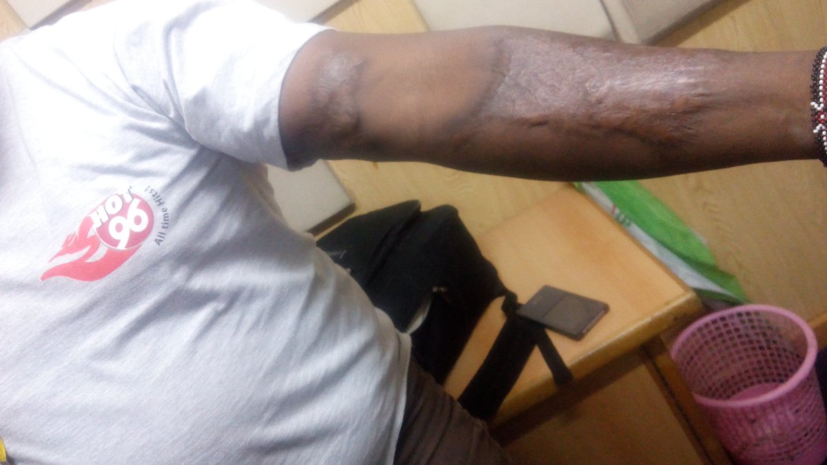 Hot_96Kenya's tweet photo. Here is @Andrewmustafa as he embraces #FlawntIt. #THEHOTBREAKFAST @DavidOyuke @Taruri What 'flaws' do you have? https://t.co/6ilRAg7cp8