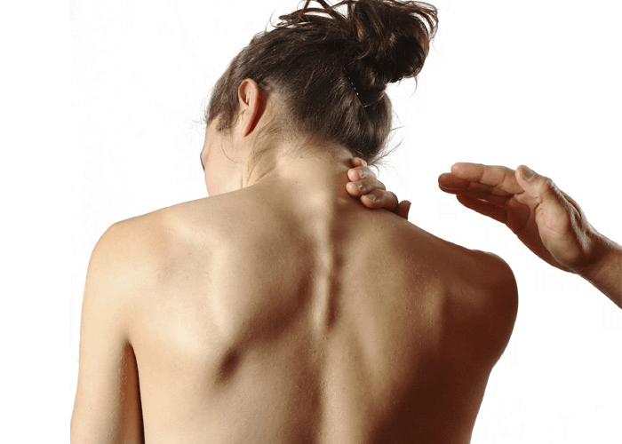 Шея со спины. Протрузии шейного отдела позвоночника. Боль в спине. Болят плечи и позвоночник. Болят плечи и позвоночник.