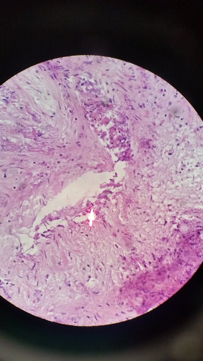 sannere's tweet photo. 50 something male, immunosupressed. these are frozens https://t.co/E8MzH7meco