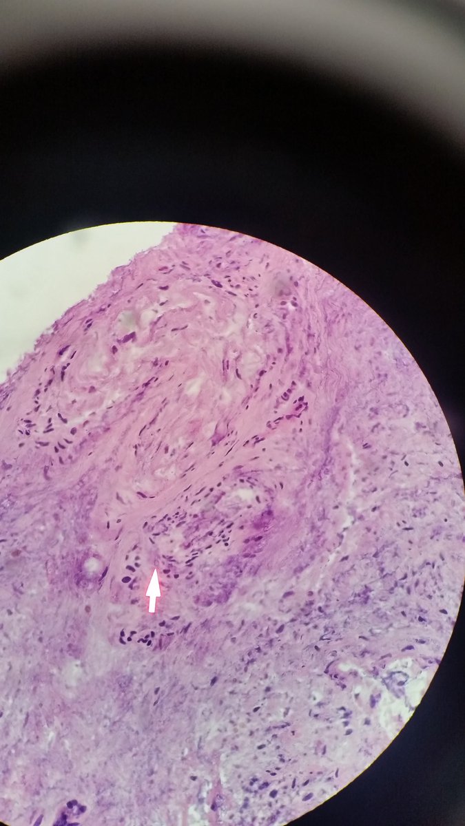 sannere's tweet photo. 50 something male, immunosupressed. these are frozens https://t.co/E8MzH7meco