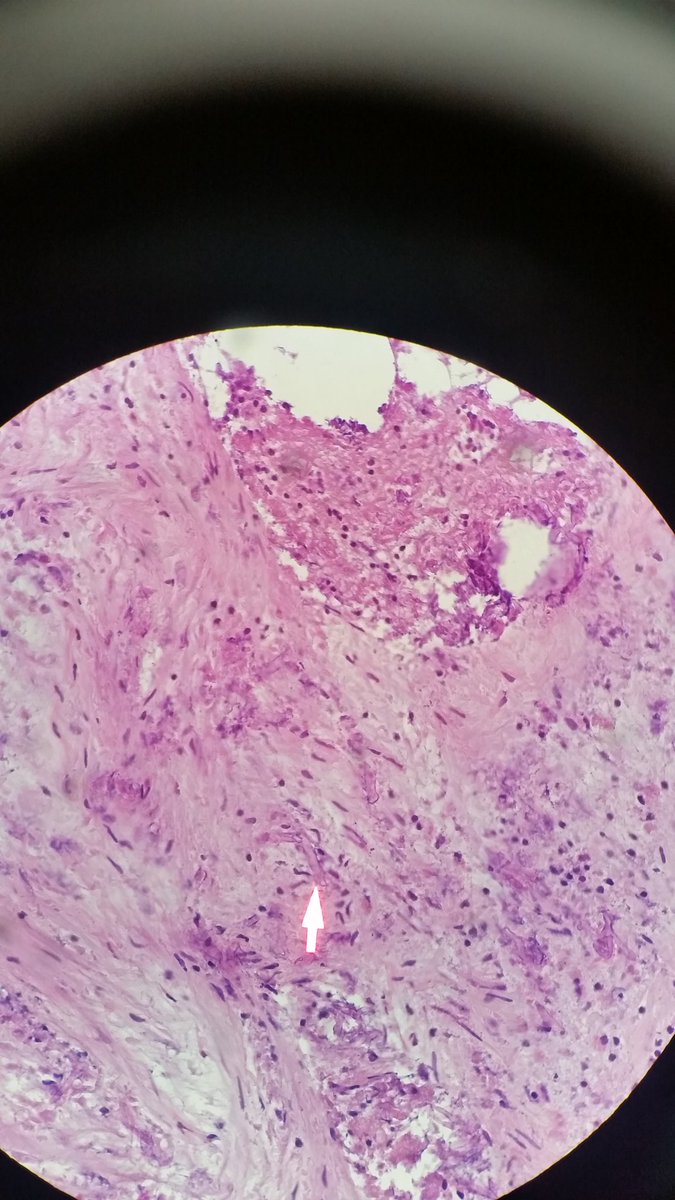 sannere's tweet photo. 50 something male, immunosupressed. these are frozens https://t.co/E8MzH7meco