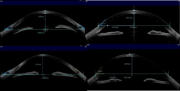 RachelDio's tweet photo. You think watching TV is good for you Find out what is Visante Optical Coherence Tomography.
https://t.co/zJtciKBgiF https://t.co/a8k55sWZlh