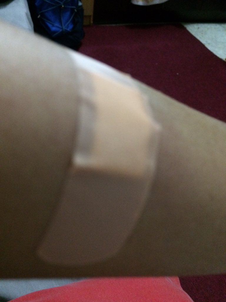 agatha1380's tweet photo. After my flu vaccine:
#Still Bleeding #Ithurts https://t.co/kRNckOa4sQ