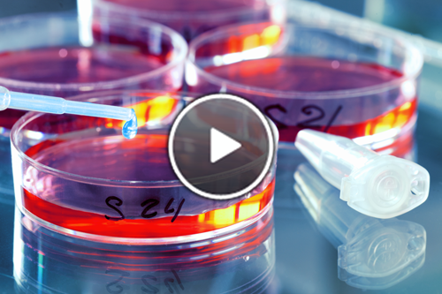 SelectScience's tweet image. New videos: #microbialdetection, improving your #cellculture and verifying #contamination bit.ly/1NbKhtd