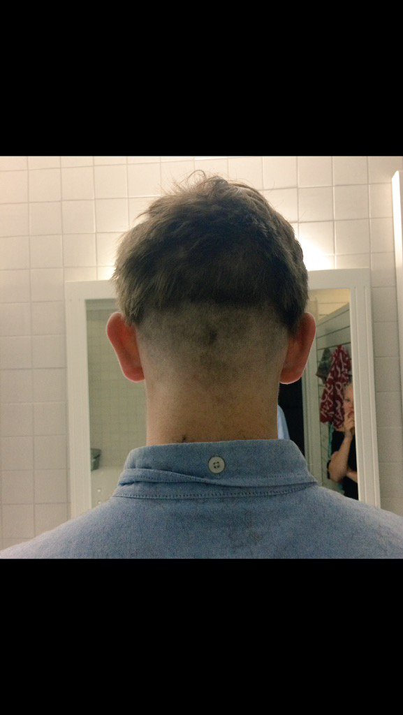 augustalex22's tweet photo. *efter fylleklippning i somras*
-det ser ju inte sååå jävla fult ut???
-haha nejdå, rätt fint faktiskt😊#skallepär https://t.co/Id7HI072Iz