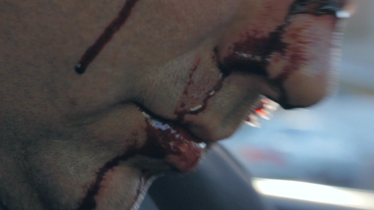 patientmanmovie's tweet photo. “I was in a car accident, it was pretty bad" - Tom #Commutter https://t.co/orRrcVsChZ
