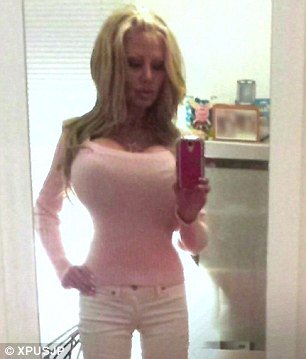 large natural looking breast implants Best of 1000cc Silicone Breast Implants
