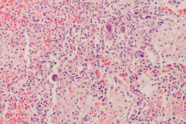 techadd1's tweet image. Probably you have Herpes: goo.gl/6aI24b?Op7e