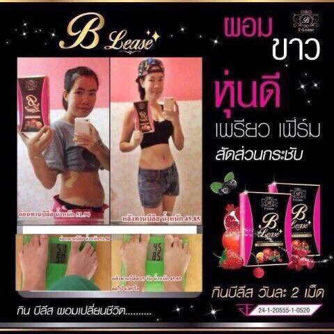 Noynar55's tweet photo. ��ีลีส จะอ้วนมาจากไหนก็จัดการได้แบบหน้าพอใจที่สุดกินแล้วยังรู้สึกว่า"เฮ้ยนำหนักลดเร็วมาก" ผอมแถมผิวใส่อีก รอไรล่ะค่ะ https://t.co/YjsyRNdIGg