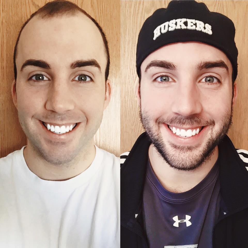 No Shave Aware tweet media