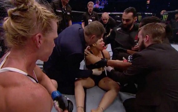 TechCraiz's tweet image. &quot;Ronda Rousey Hospitalized After Fight&quot; cybergrit.com/?p=107&amp;amp;XiNM9 #ufc #news #media #bigdata #entertainment #sports