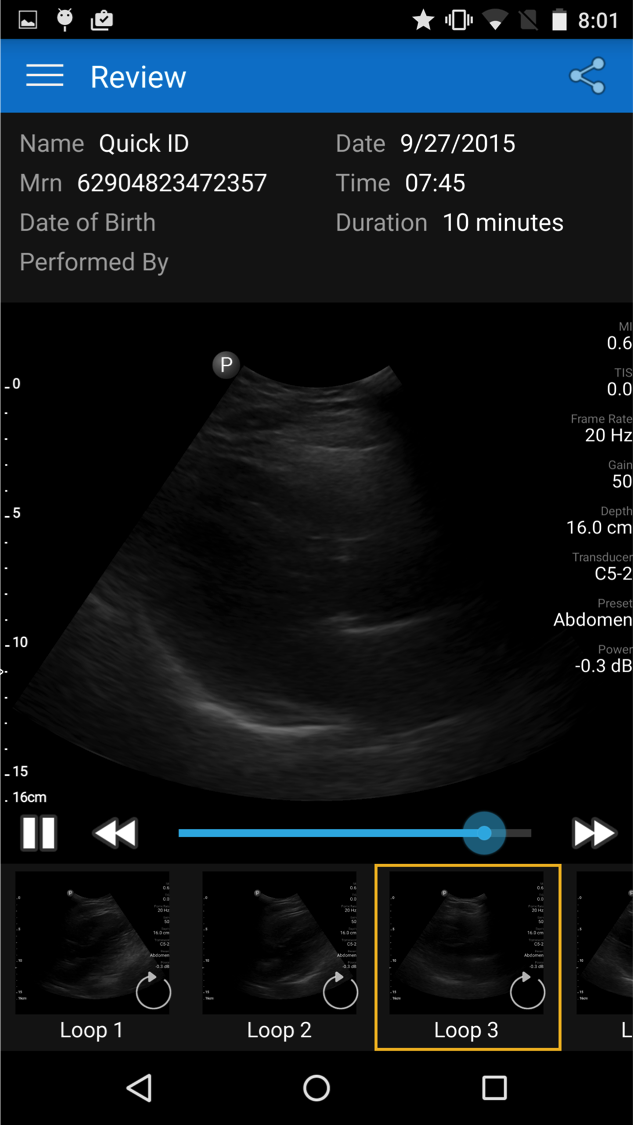 EricTopol's tweet image. A big day for smartphone ultrasound: probe connect to Droid phone; $199/mo @philipshealth lumify.philips.com/web/