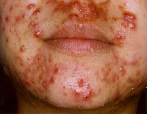 esteroides de baja potencia - ¡Relájate, es hora de jugar!