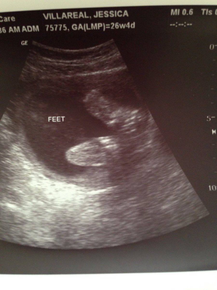 jessiejunoo's tweet photo. My sons feet <3 <3 D'Angelo D. Calderon Jr. #Feb142016 https://t.co/uMvxrtf9mU