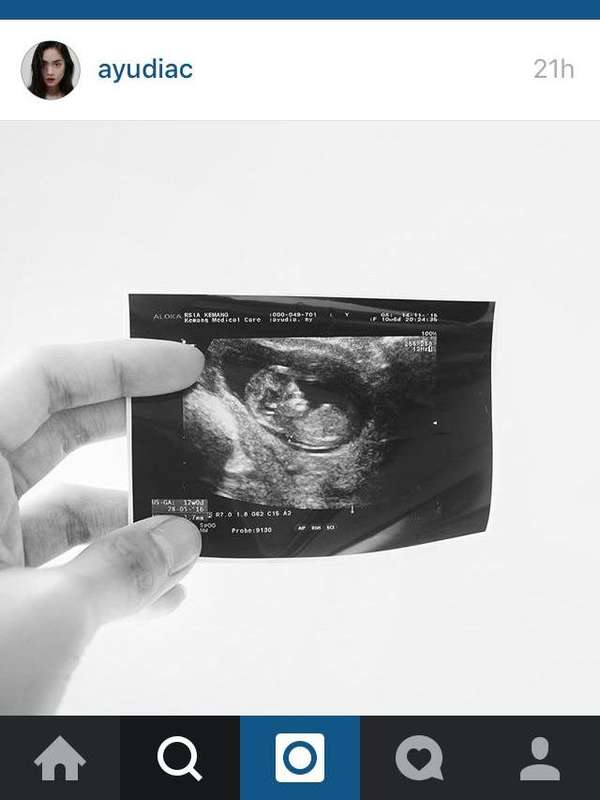 Ayudia Bing Slamet Hamil Anak Pertama de.tk/663Lfc via <a href="/detikHot/">detikhot</a>