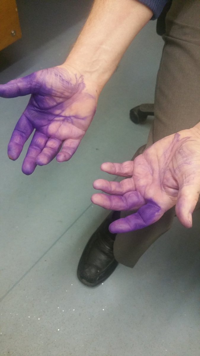 Ecohoof's tweet photo. Tom thought he had picked up the soap spray to clean his hands #PurpleSpray #PurpleHands #AtLeastWeKnowOurSprayStays https://t.co/CvA4jf0Fwh