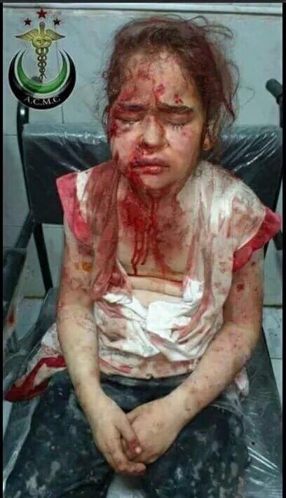 cobanyatak's tweet photo. Küçük bir çocuğun kuşu öldü diye başsağlığına giden Peygamberimizin,
Binlerce müslüman ölürken susan ümmetiyiz.. https://t.co/vcKSC74gFA