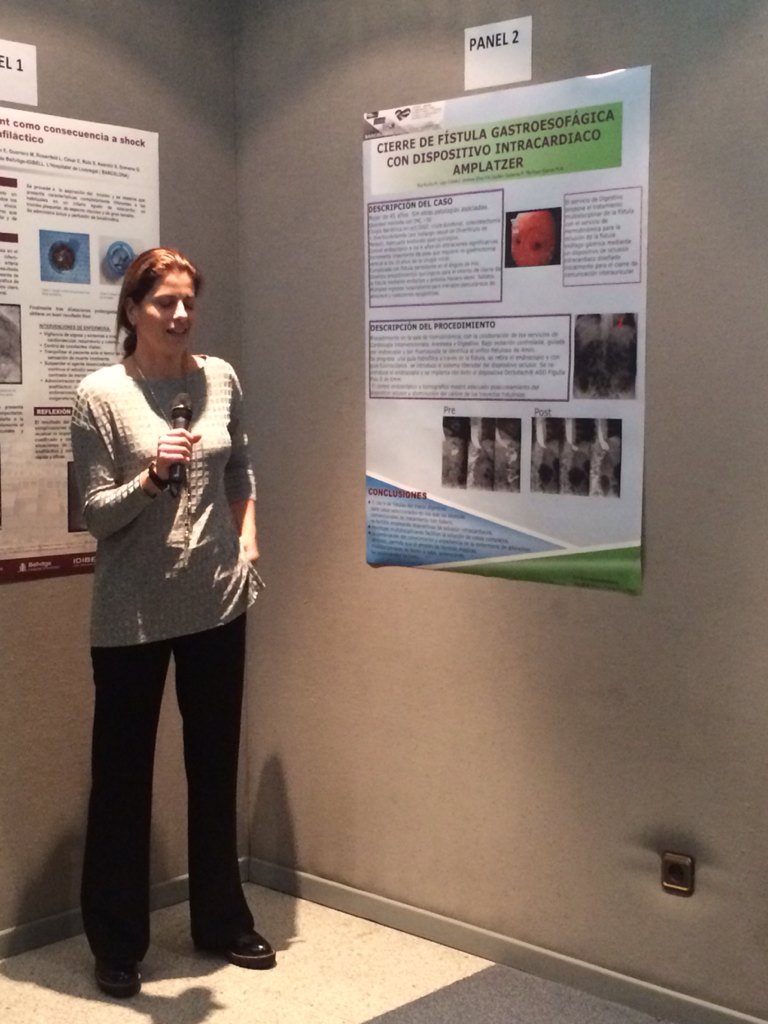 enferhemo's tweet image. #posterforum #CSC15 enferm:Helena Rey.Vigo.Cierre de fístula gastroesofágica con dispositivo intracardiaco amplatzer