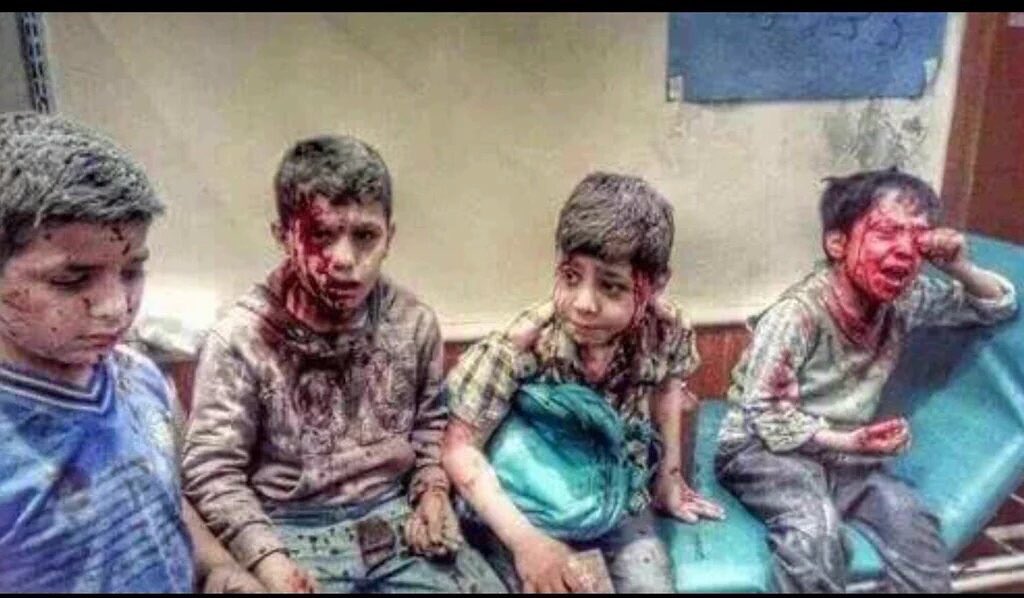 Korayizitas1's tweet photo. Çocuklar ölüyor ve bu çocuklar Türk olduğu için dünya sessiz !#UyumaTürkiyeSahipÇıkTürkmene https://t.co/1AJDHcR3Ws