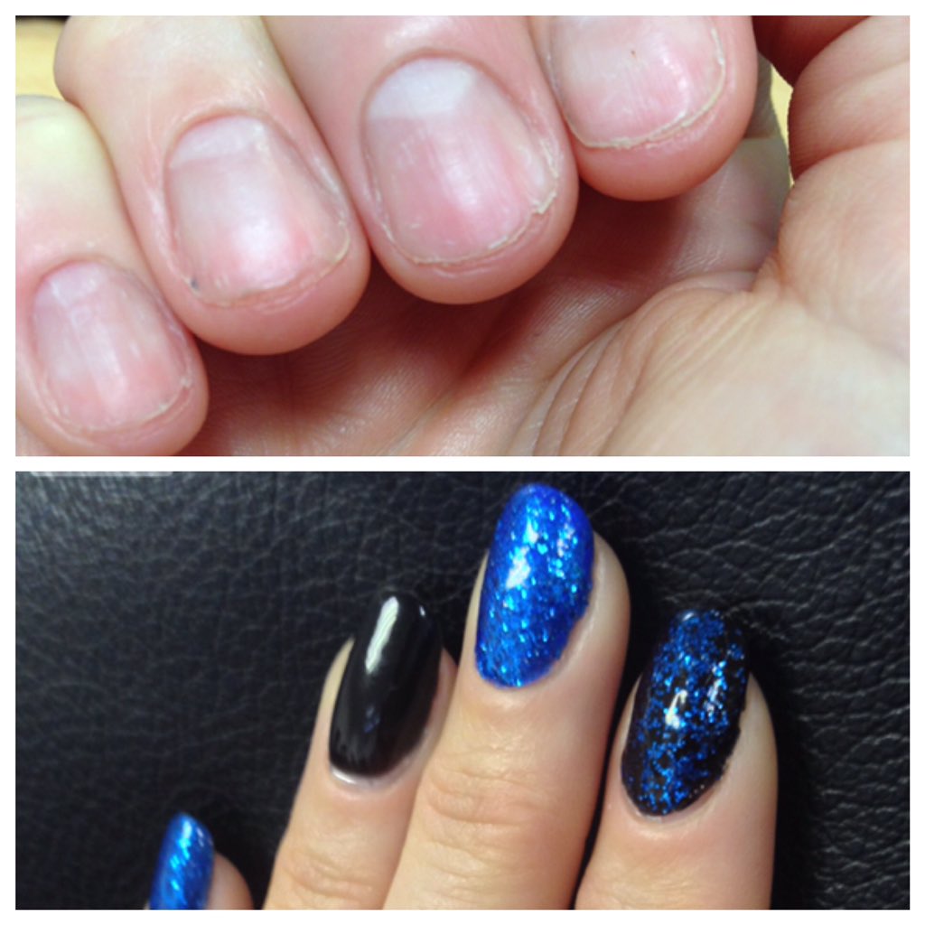 Libertenails's tweet photo. #IBXRepairing my nails to get them from this to this. https://t.co/cSwq2FUBom