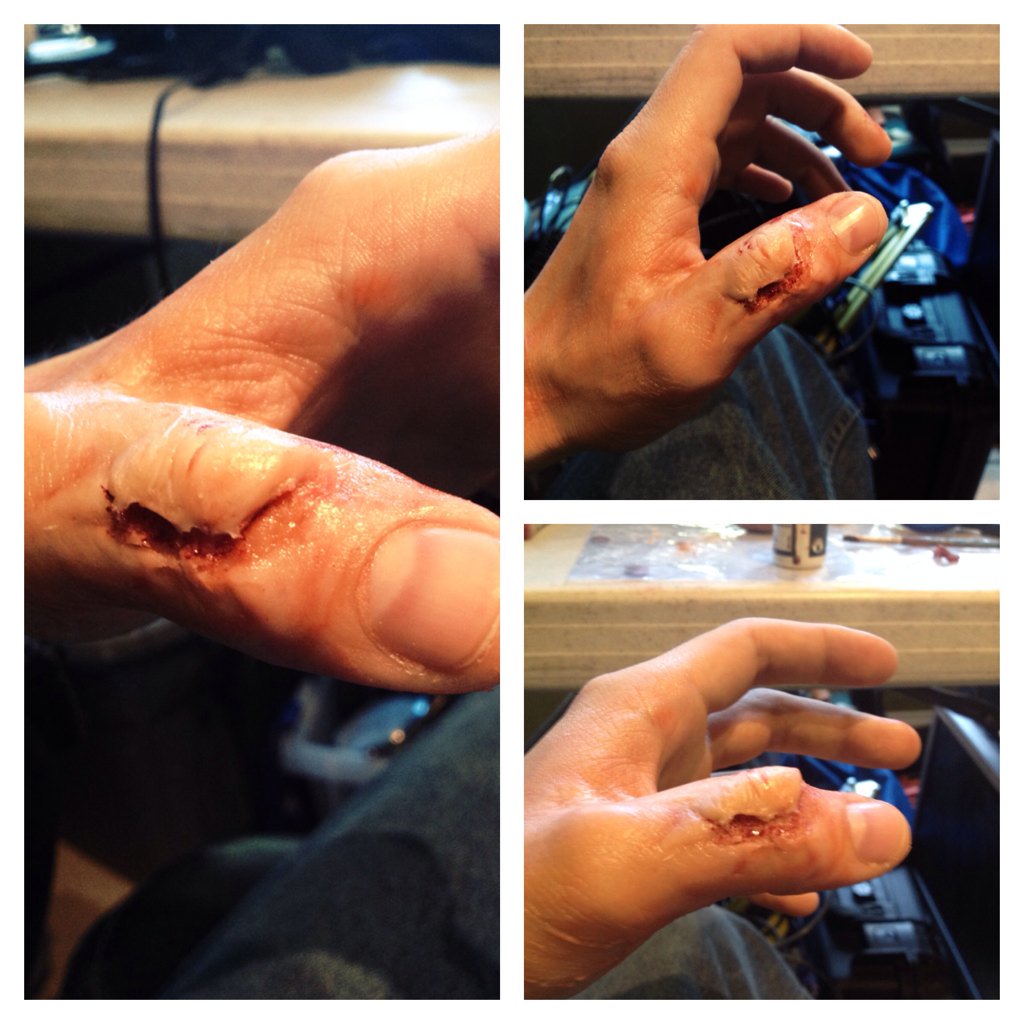 Thegeraldcrum's tweet photo. Okay I did the busted finger for one of the scenes we gonna shoot in film #fx #fallofgrace https://t.co/UlRyH8FyBB