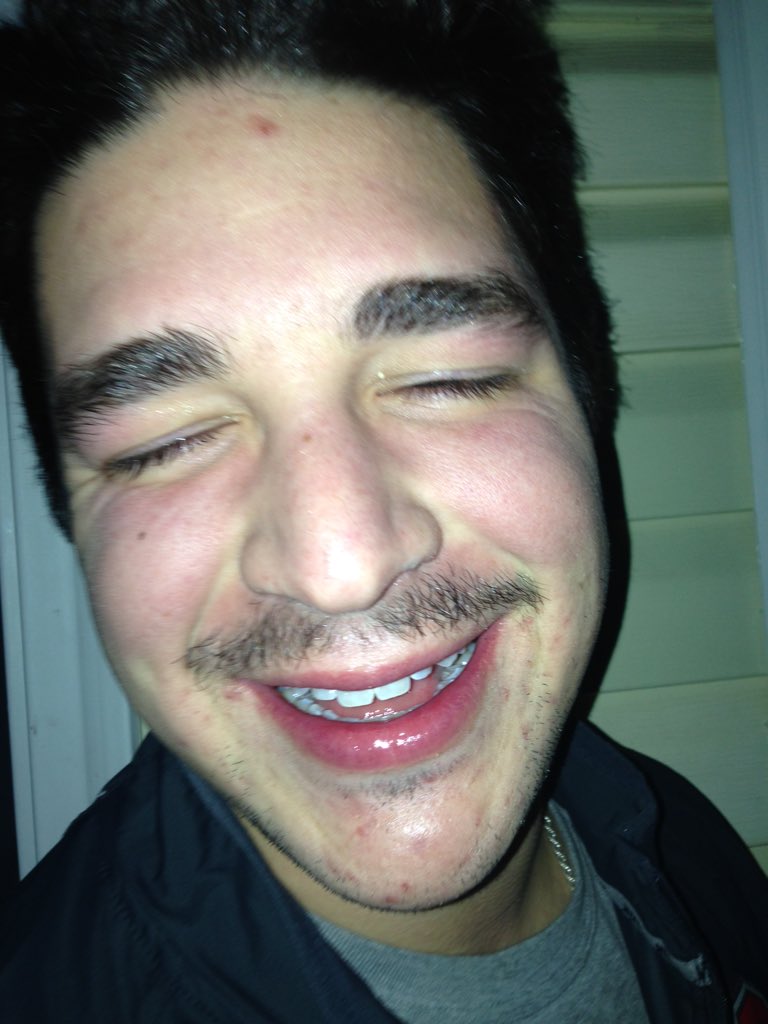 NotAjBurns's tweet photo. Update #2 just puked and rallied https://t.co/6ya4oTZ9mV