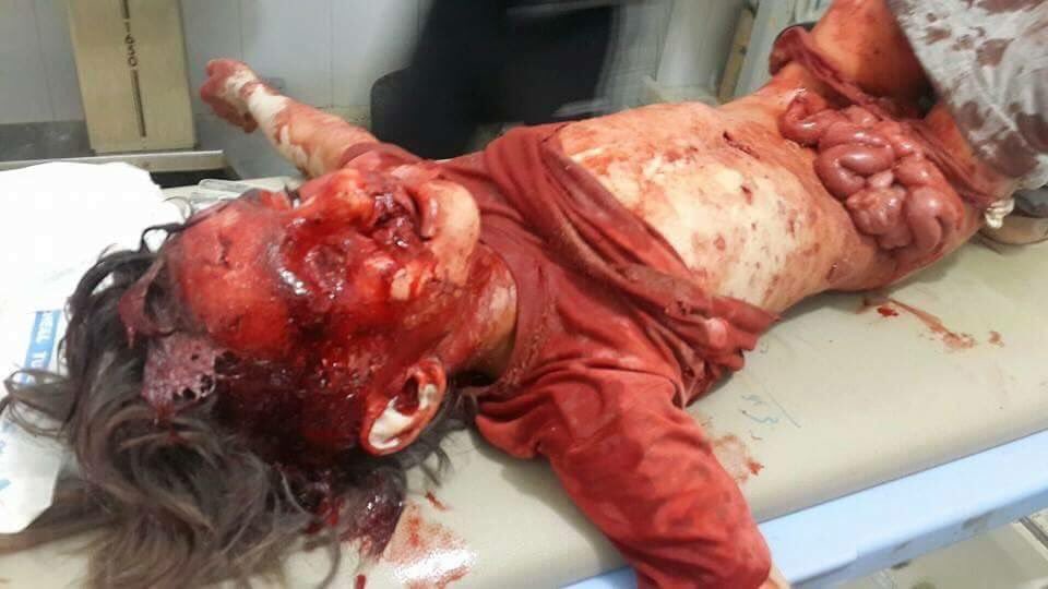 ALJASEM_MOHAMAD's tweet photo. البارحة أقام العالم اجمع من اجل مجزرة فرنسا
واليوم لاارىراحد يتكلم من مجزرة الأطفال في درعا
صبراً يااهالي درعا https://t.co/VGzqmrtNhx