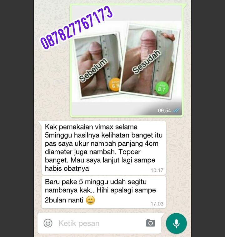 vimaxdibandung's tweet image. Jual #Vimax Asli Obat pembesar penis, Ampuh! bbm 57F9C9C9 |&amp;gt;onclinic24.net #bisyar #bispak @IklanSOLO