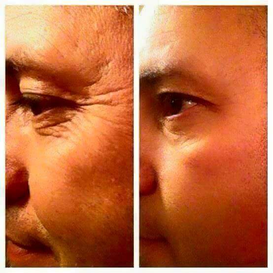 liddlee's tweet image. Uploft eye surum look at the difference its amazing it working in just seconds 
youniqueproducts.com/lovemakeup