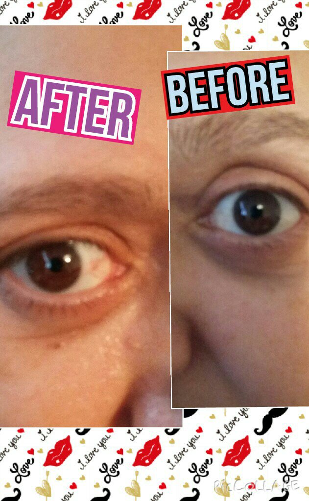 liddlee's tweet image. Uploft eye surum look at the difference its amazing it working in just seconds 
youniqueproducts.com/lovemakeup