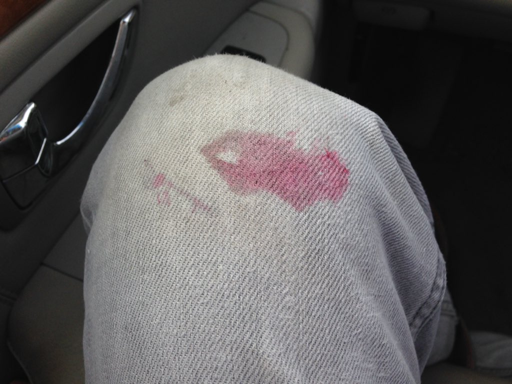 khayters's tweet photo. Just washed and dried my pants yesterday. Knelt onto a raspberry this morning. #katelyfe #heaviestsighever #tjslyfe https://t.co/l7tjWeLzqP