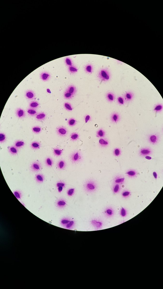 simplymacey's tweet photo. Amazing sperms 😃
#spermdnafragmentation #beautifulstain https://t.co/IUGjm9zpAF