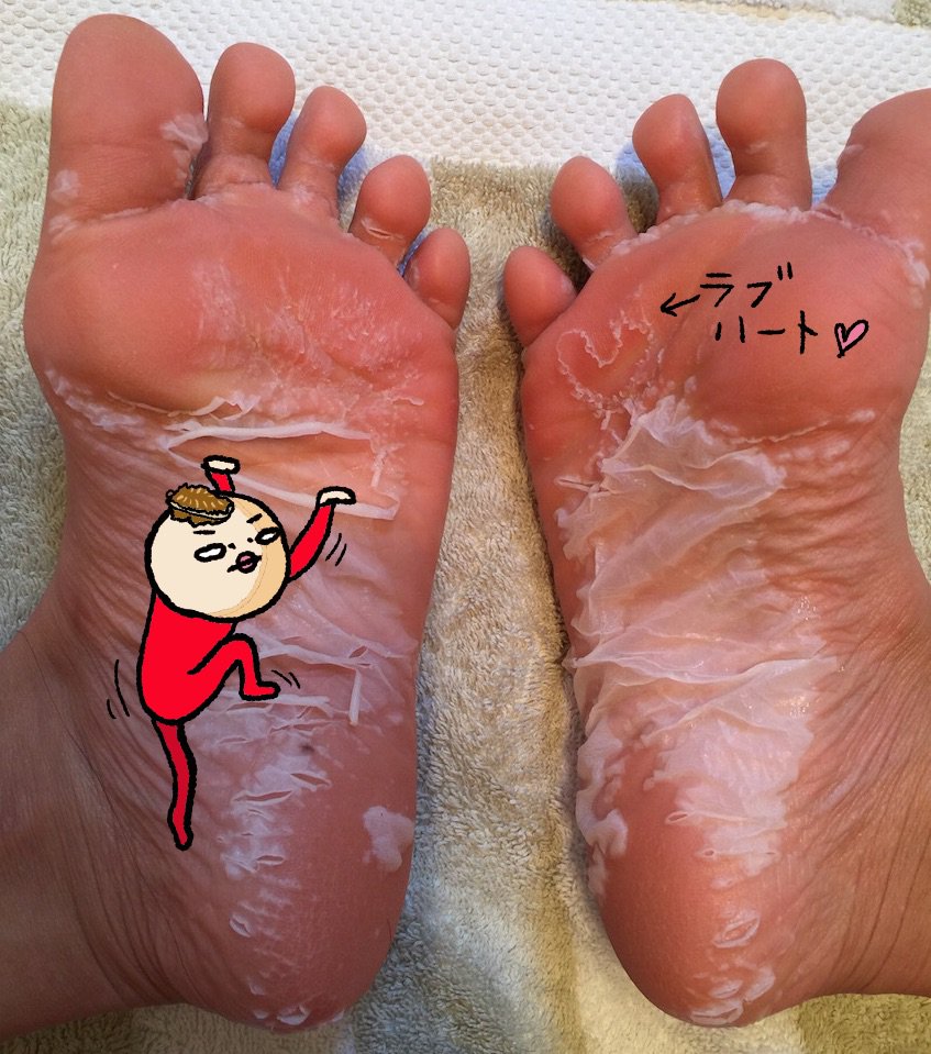 ワタシ 再投稿 なぜなら ぺ 半濁音pe ビーフットと書いてしまったから ハートつけてくれた貴方 ごめんっ やり直しです ベビーフット のずるむけコンテストに応募しました T Co I7u7cxpdbw ワタシ 再投稿 なぜなら ぺ 半濁音pe ビーフットと書いてしまったから ハートつけてくれた貴方 ごめんっ やり直しです ベビーフット のずるむけコンテストに応募しました T Co I7u7cxpdbw
