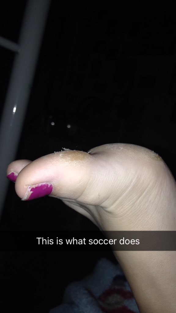 kylies_toes's tweet photo. If you can't take the heat get outta the kitchen 💯💯💯 #dedication #competingagainstmyself #daybyday#fitgirl https://t.co/Nt2XOwMg7x
