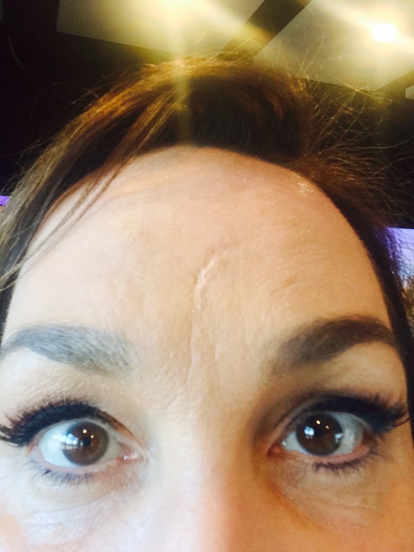 katelangbroek's tweet photo. Wait till @DrChrisMoss kicks your ass, #scar! @LibertyBelleAUS https://t.co/GXP2BBfbzP