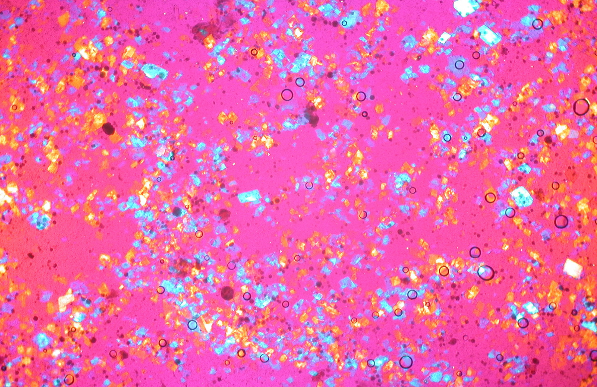 LIFEmagNews's tweet photo. News: New vaccine could prevent high cholesterol! Read more at  https://t.co/iDlzL0fyeM #medicine #future https://t.co/twF3mfj9gV