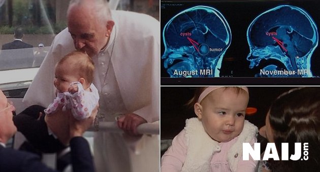 Un baiser du pape François  aurait guéri la tumeur d'un bébé (Vidéo) CUfqZWZU8AAV4ww