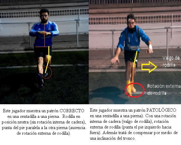 fity_4's tweet photo. Que mejor forma d aprender que aplicar los conocimientos que nos ofrece @NachoGZas⬆riesgo de lesión rodilla (jug➡) https://t.co/v3QbQWgjsD