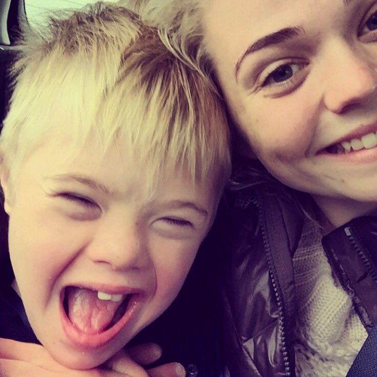 @siljarg bráðsmitandi, er með downs í dag 😷😷