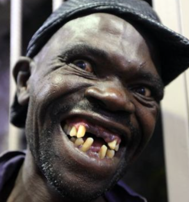Man ugly the world 10 Ugliest