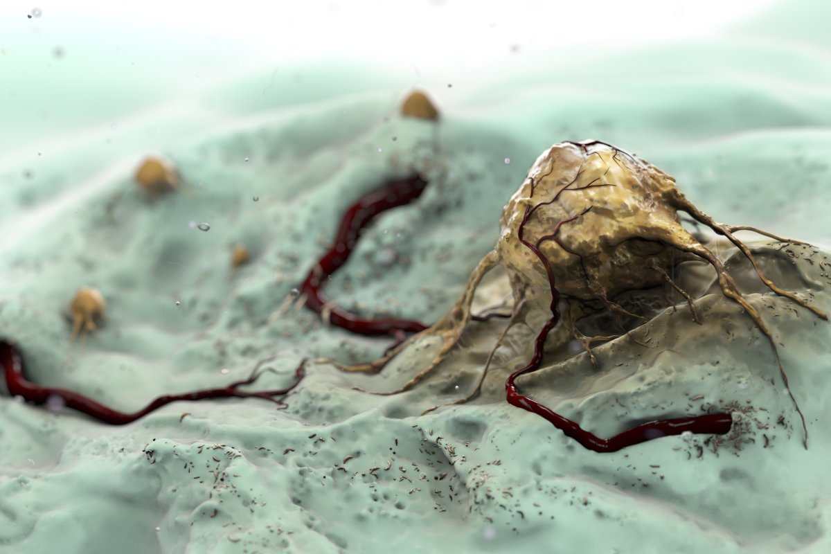 taylortang861's tweet image. Doctors grow tumors that roll up like toilet paper - bit.ly/1kR0tng #gadgetreviews  #gadgetguide